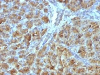 Anti-CELA3B / Elastase 3B Antibody
