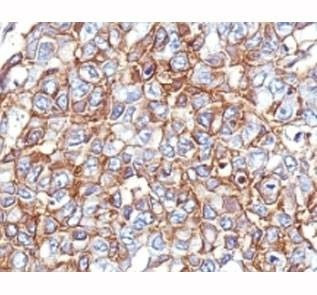 Anti-EpCAM Antibody Cocktail