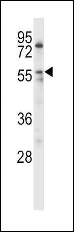 Anti-LPL (Center) Antibody