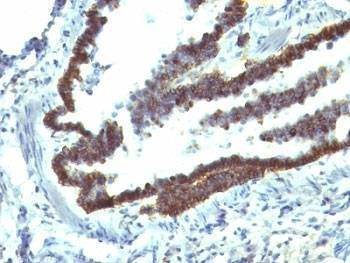 Anti-EpCAM Antibody
