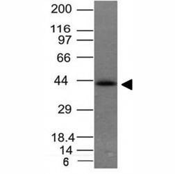 Anti-EpCAM Antibody