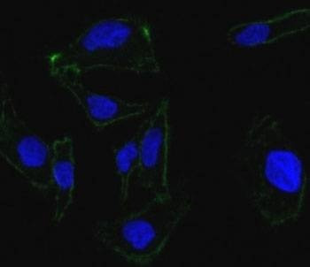 Anti-EpCAM Antibody