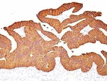 Anti-EpCAM Antibody