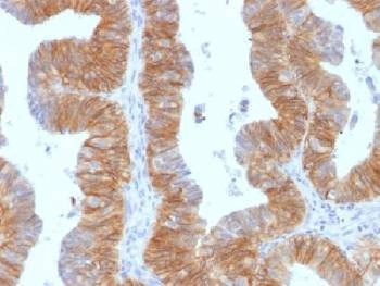 Anti-EpCAM Antibody