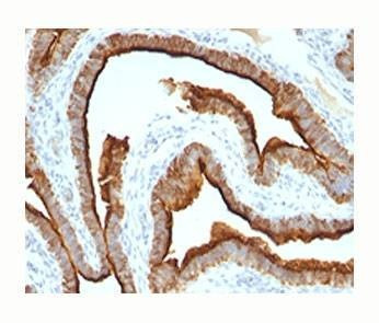 Anti-Epithelial Marker Antigen Antibody