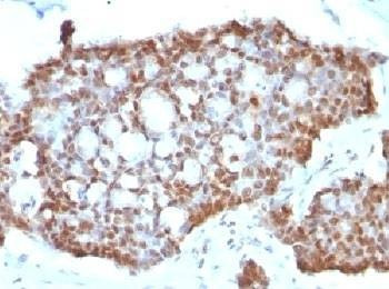 Anti-Estrogen Receptor beta Antibody