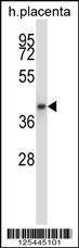 Anti-GNAQ (N-term) Antibody