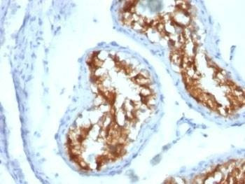 Anti-Fascin Antibody
