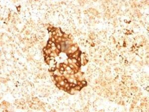Anti-Ferritin Antibody (light chain specific)
