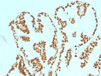 Anti-FOXA1 Antibody