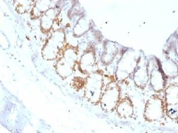 Anti-FOXA1 Antibody