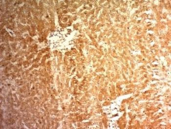 Anti-Glypican-3 Antibody