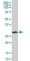 Anti-CITED1 Antibody