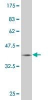 Anti-CITED1 Antibody