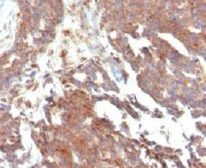 Anti-GnRHR Antibody