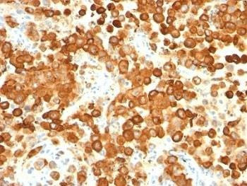 Anti-gp100 Antibody Cocktail