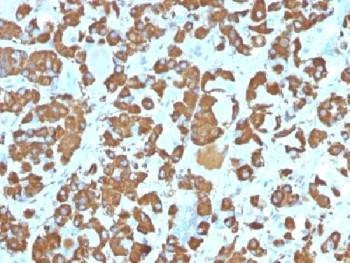 Anti-Growth Hormone Antibody (pituitary)