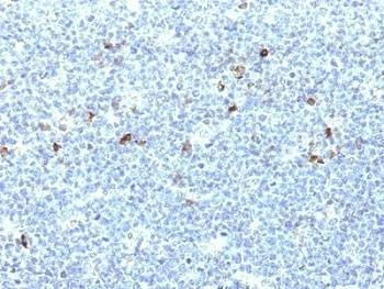 Anti-HLA-A25 Antibody (HLA-Aw32)