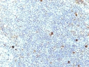 Anti-HLA-A25 Antibody (HLA-Aw32)