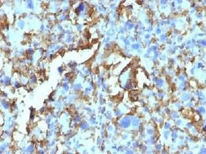 Anti-HLA-DRB1 Antibody Cocktail (MHC II)