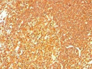 Anti-HLA-DRB1 Antibody Cocktail (MHC II)