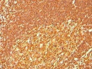 Anti-HLA-DRB1 Antibody (MHC II)