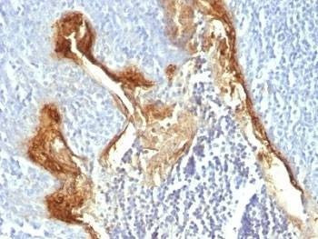 Anti-Involucrin Antibody
