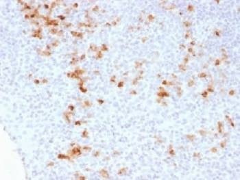 Anti-Kappa Light Chain Antibody