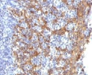 Anti-Keratin 14 Antibody (K14)