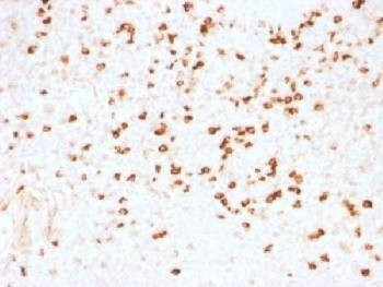 Anti-Lambda Light Chain Antibody