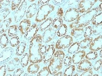 Anti-Laminin gamma 1 Antibody