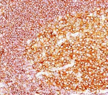 Anti-MALT1 Antibody