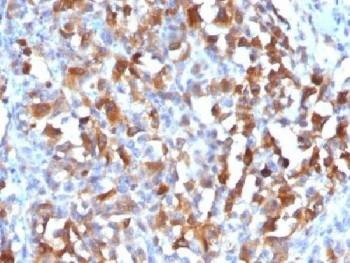 Anti-Melan-A / MART-1 Antibody