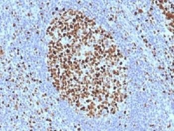Anti-MCM7 Antibody