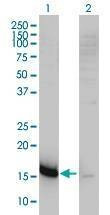 Anti-CKLFSF5 Antibody