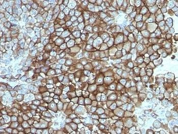 Anti-Melanoma Associated Antigen KBA.62 Antibody