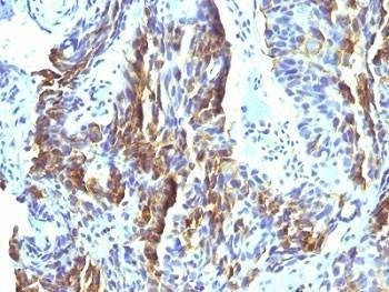 Anti-Melanoma Associated Antigen KBA.62 Antibody