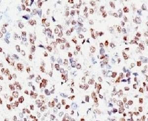 Anti-MITF Antibody