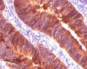 Anti-MUC-1 Antibody
