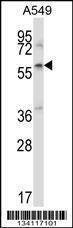 Anti-ZBTB7A (C-term) Antibody
