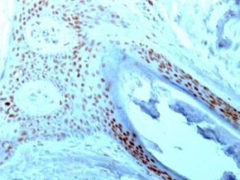 Anti-NCL Antibody