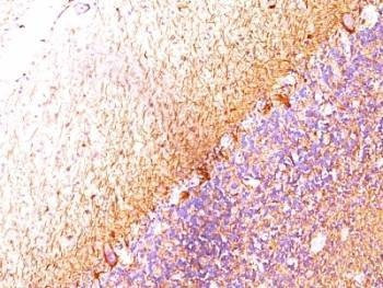 Anti-Neurofilament Antibody