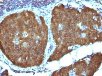 Anti-NSE Antibody