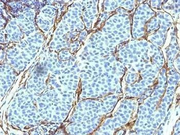 Anti-NGF Receptor Antibody