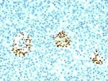 Anti-NKX2.2 Antibody