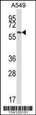 Anti-FZD5 (C-term) Antibody