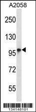 Anti-TMC6 (N-term) Antibody