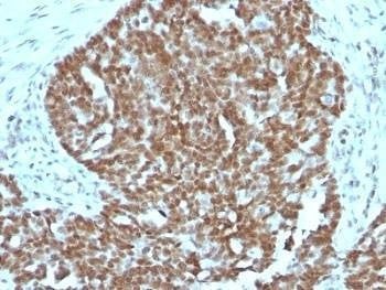 Anti-Nucleolin Antibody Cocktail