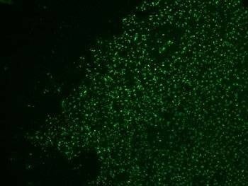 Anti-Nucleolin Antibody Cocktail