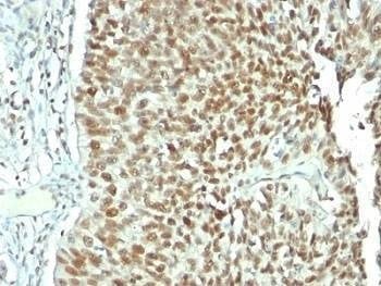 Anti-Nucleolin Antibody